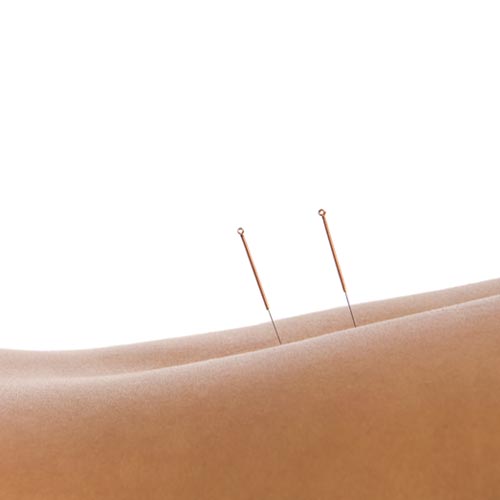 Auto Injury Treatment PB 50 50 Pic 2